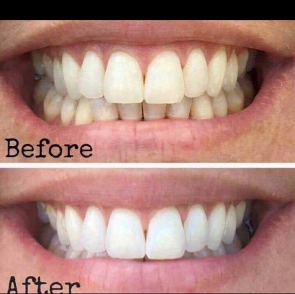 Magic toothpaste - Picture 3 of 3